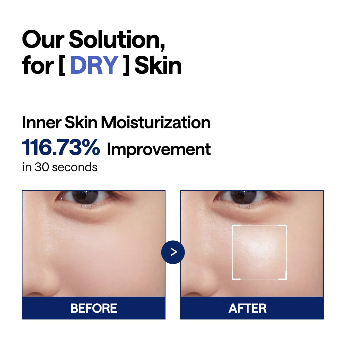 MEDIHEAL Watermide Deep Moisture Pad